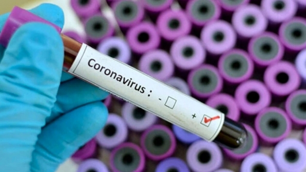 Türk Tabipler Birliği: Koronavirüs korumalarını sağlayacak tıbbi malzeme yetersiz