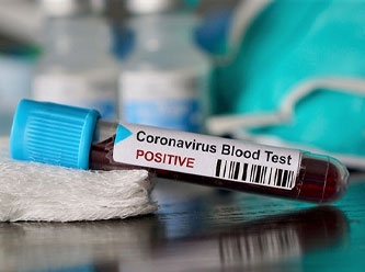 Koronavirüs vücuda nasıl saldırıyor?