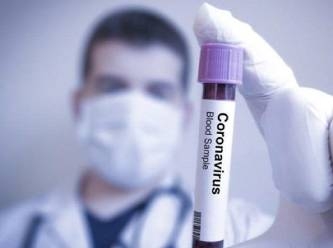 Koronavirüs tahlil bilgilerini gizleyen iki laboratuvara soruşturma