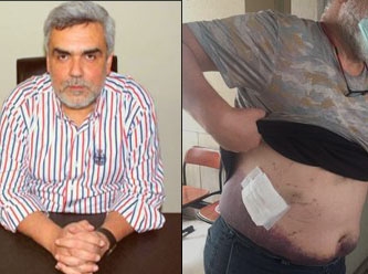 Zulmün böylesi: Adana’da açık kanaması olan hayırsever, tutuklanarak cezaevine gönderildi