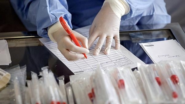 Sağlık Bakanlığı zorunlu Covid-19 PCR testi için 110 TL fark ücreti istiyor!