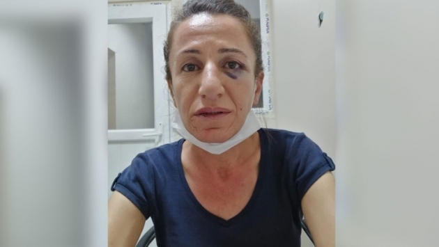 İşkenceye maruz bırakılan Rojbin Çetin tutuklandı