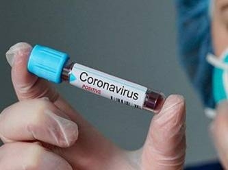 Türkiye'den yurt dışına çıkacaklara test şoku: Koronavirus PCR testine fahiş zam