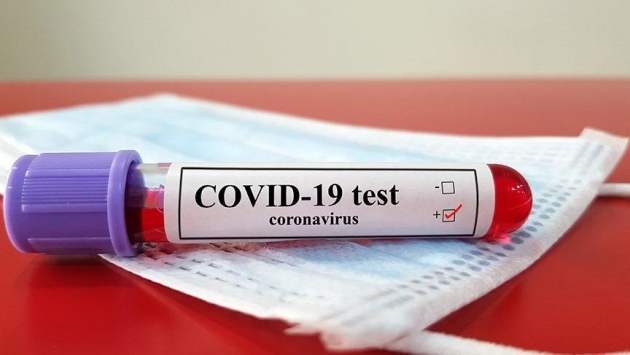 Kovid-19 test kitlerinin tek yetkili firması, hac ve umre organizatörü çıktı!