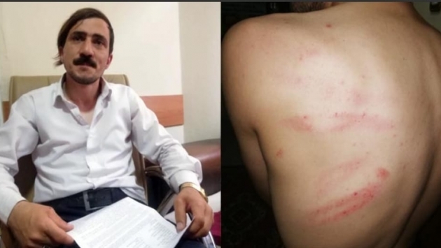 Yeniçağ muhabirinin belediye binasında dövülmesinin görüntüleri ortaya çıktı