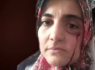 Kanser hastası Ayşe Özdoğan, CHP’li Gülizar Biçer Karaca ile görüştürülmedi