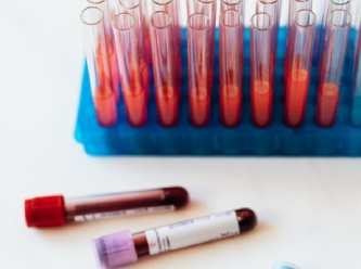 Kan testi ile kanseri erken teşhis etmek mümkün mü?