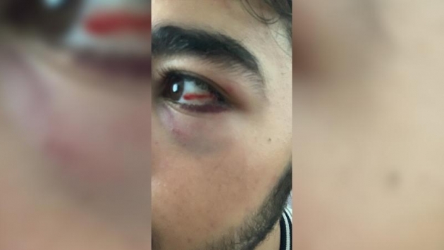 İstanbul'da 3 Arap asıllı çocuk saldırıya uğradı