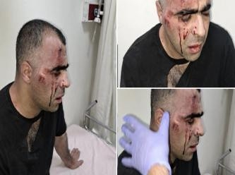 Gazeteci Aygül: Belediye başkanının korumalarının saldırısına uğradım