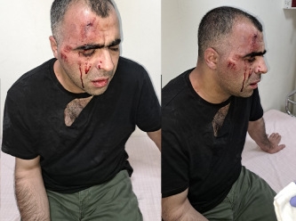 Gazeteci Aygül'e saldıran korumadan pes dedirten savunma