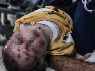 İsrail yine sivilleri hedef aldı: Gazze’de kan donduran görüntüler