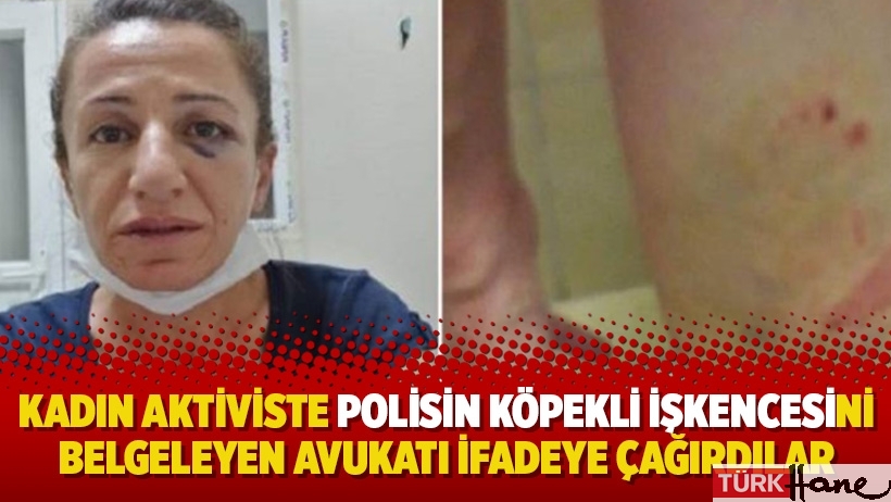 Kadın aktiviste polisin köpekli işkencesini belgeleyen avukatı ifadeye çağırdılar