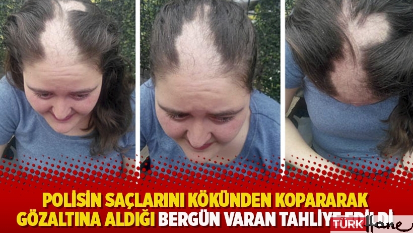 Polisin saçlarını kökünden kopararak gözaltına aldığı Bergün Varan tahliye edildi