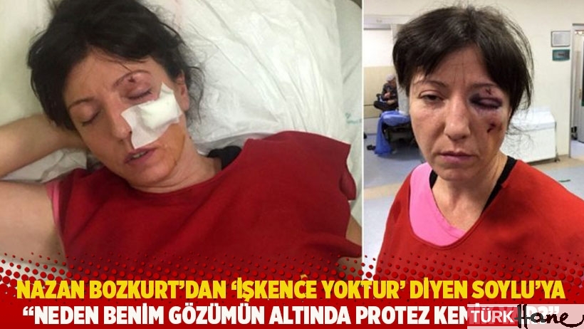 Nazan Bozkurt’tan ‘İşkence yoktur’ diyen Soylu’ya: Neden benim gözümün altında protez kemik var?