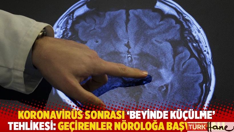 Covid sonrası ‘beyinde küçülme’ tehlikesi: Geçirenler nöroloğa başvurmalı