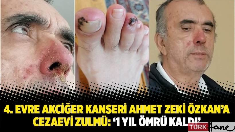 4. evre akciğer kanseri Ahmet Zeki Özkan’a cezaevi zulmü: ‘1 yıl ömrü kaldı’