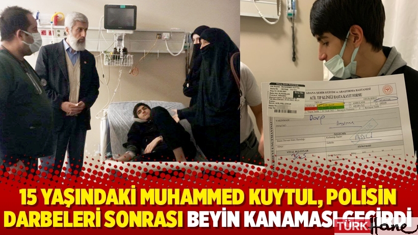 15 yaşındaki Muhammed Kuytul, polisin darbeleri sonrası beyin kanaması geçirdi