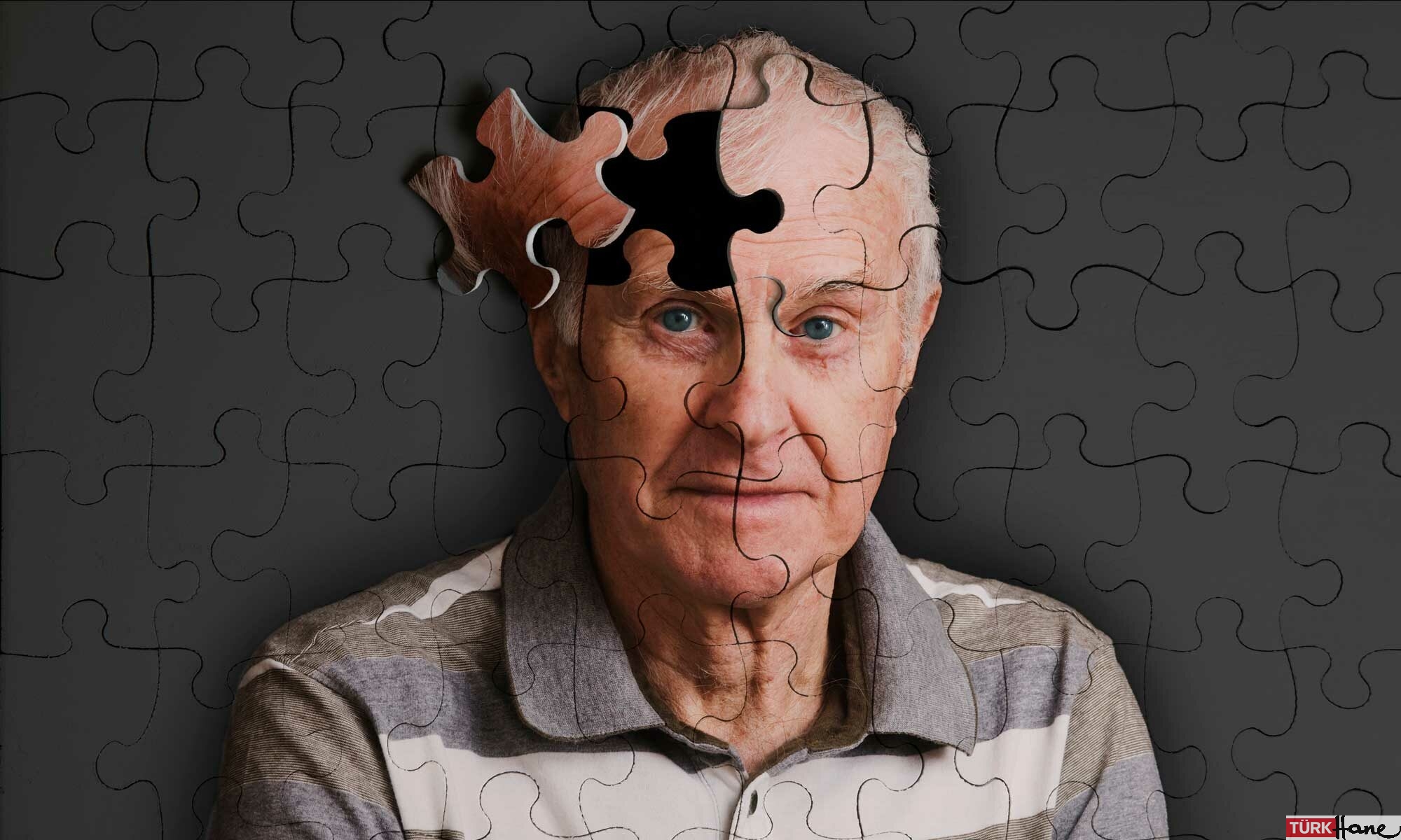 Alzheimer belirtisi: Bağırsak bakterisindeki değişim