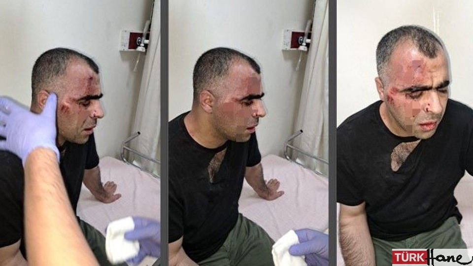 Kılıçdaroğlu’ndan saldırıya uğrayan gazeteci Sinan Aygül’e geçmiş olsun telefonu