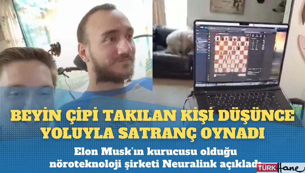 Beyin çipi yerleştirilen kişi düşünce yoluyla satranç oynadı