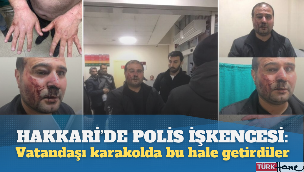 Hakkari’de polis işkencesi: Vatandaşı karakolda dövüp bu hale getirdiler