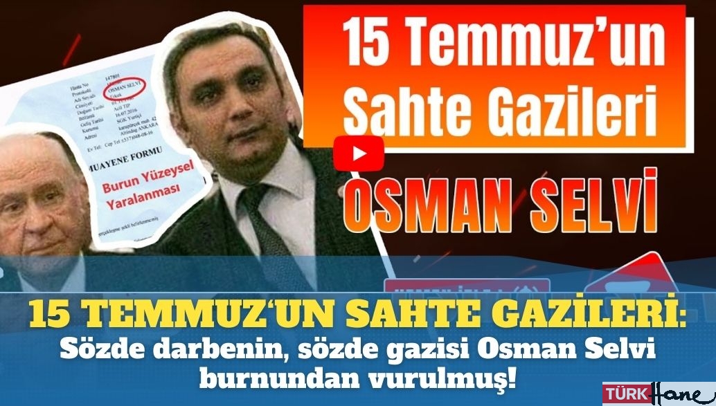 15 Temmuz’un sahte gazileri: Sözde darbenin, sözde gazisi Osman Selvi burnundan vurulmuş!