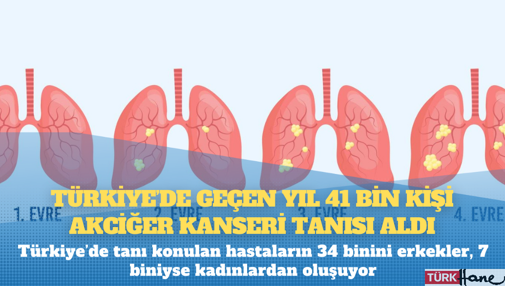 Türkiye’de geçen yıl 41 bin kişi akciğer kanseri tanısı aldı