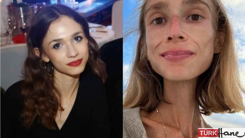Meyve diyeti fenomenin sonu oldu