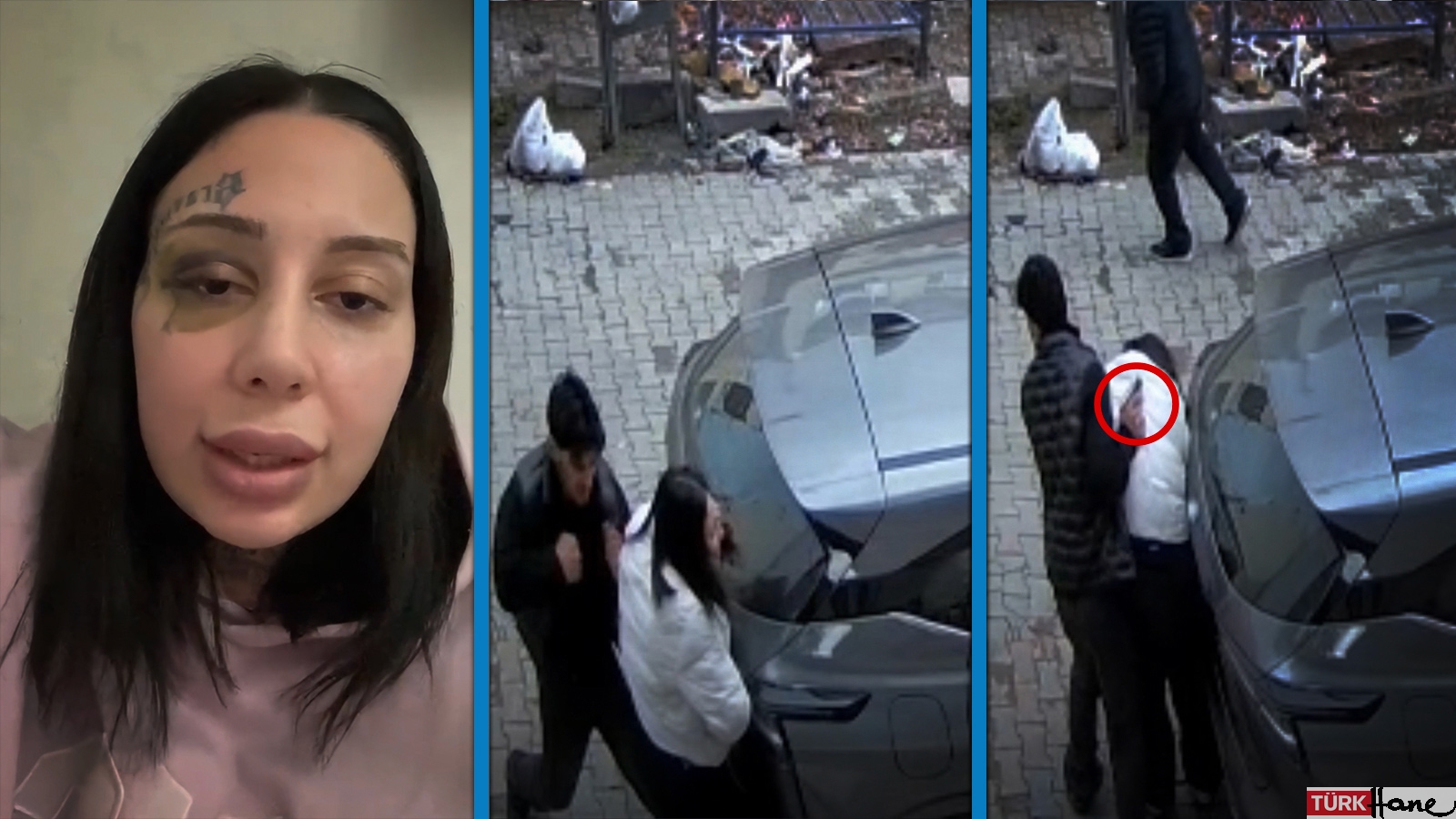 Boşanma aşamasındaki eşi tarafından silah çekilip darbedilen Yağmur: Hamile kaldım, evlendik, şiddet başladı