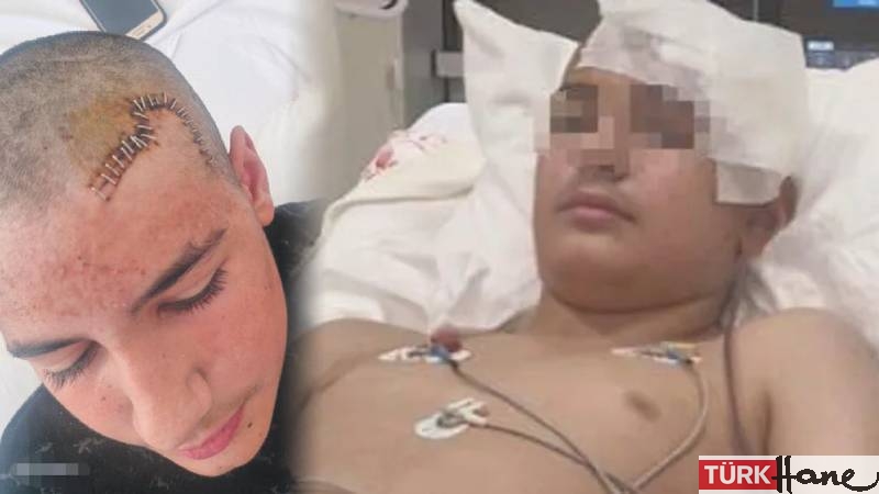 Konya’da akran şiddeti: 13 yaşındaki çocuğun kafatası taşla kırıldı, serbest bırakılan saldırgan “baba tahl