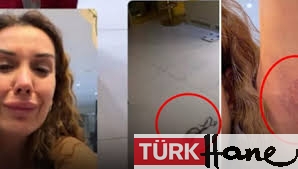 Dilan Polat en yakınından tekme tokat dayak yedi