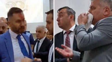 Büyük kavga çıktı: MHP’li meclis üyesi, CHP’li üyenin burnunu kırdı